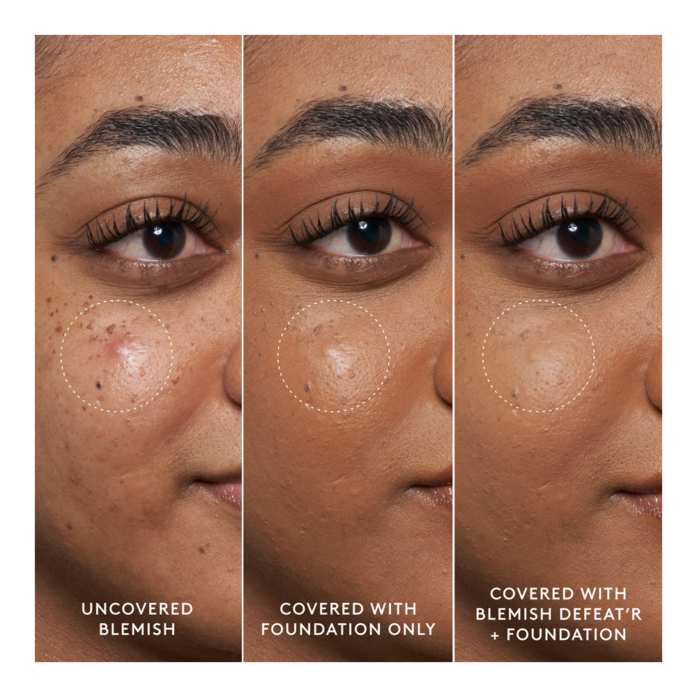 Blemish Defeat'r BHA Spot Targeting Gel - 15ml