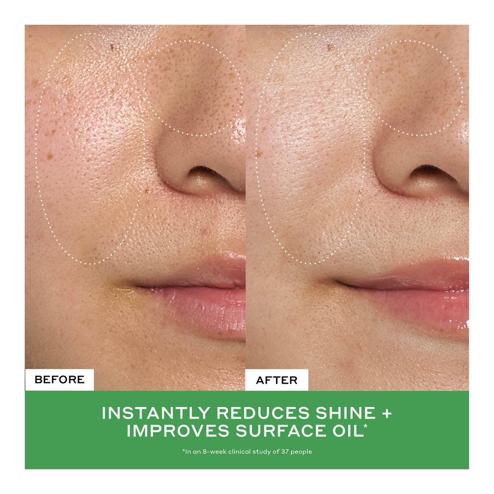 Detox Drops 2% Salicylic Acid Anti-Blemish Toner - 120ml