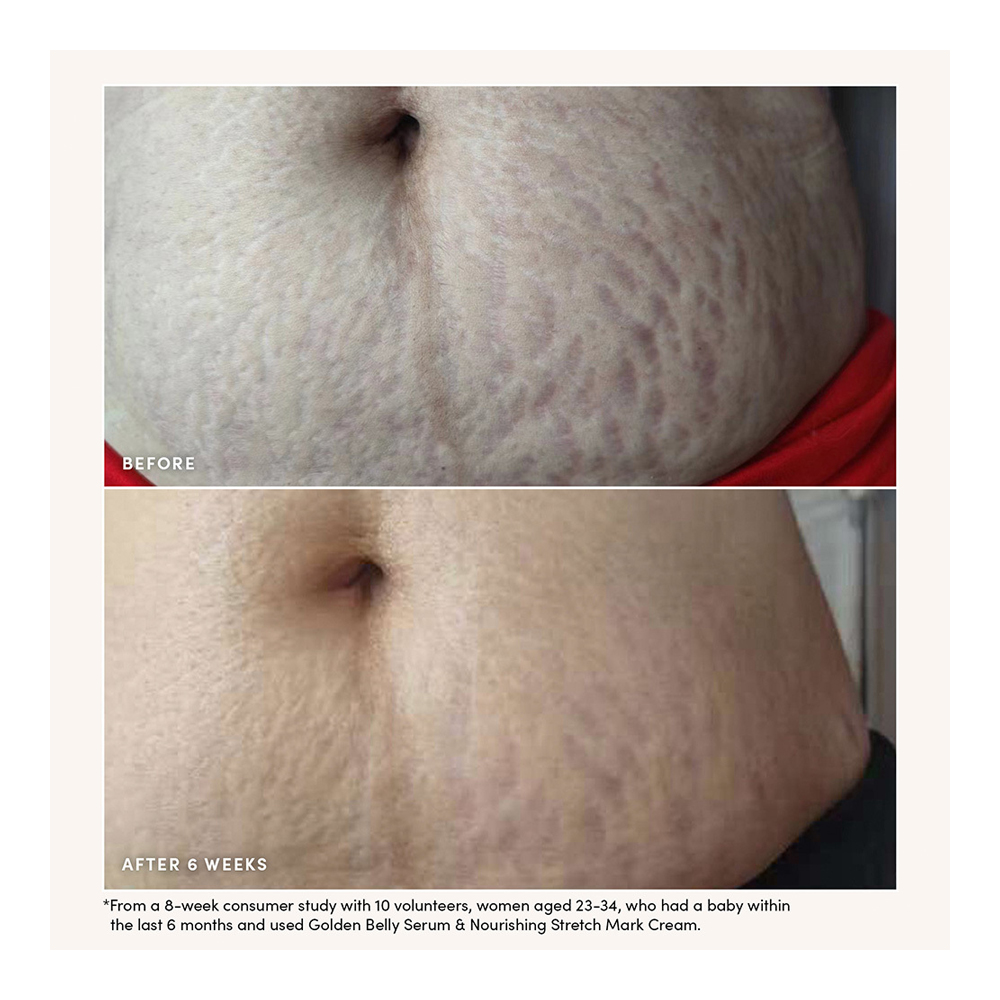 Nourishing Stretch Mark Cream - 120ml