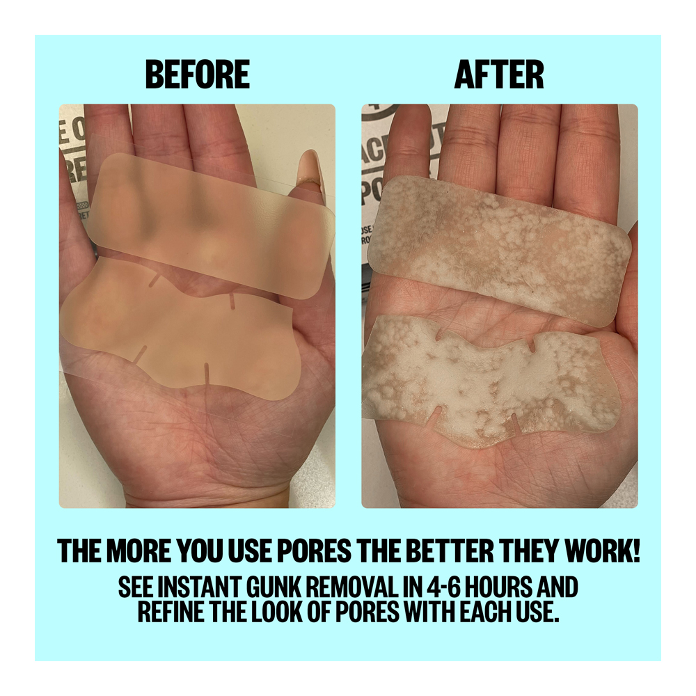 Pores - 8 Pieces