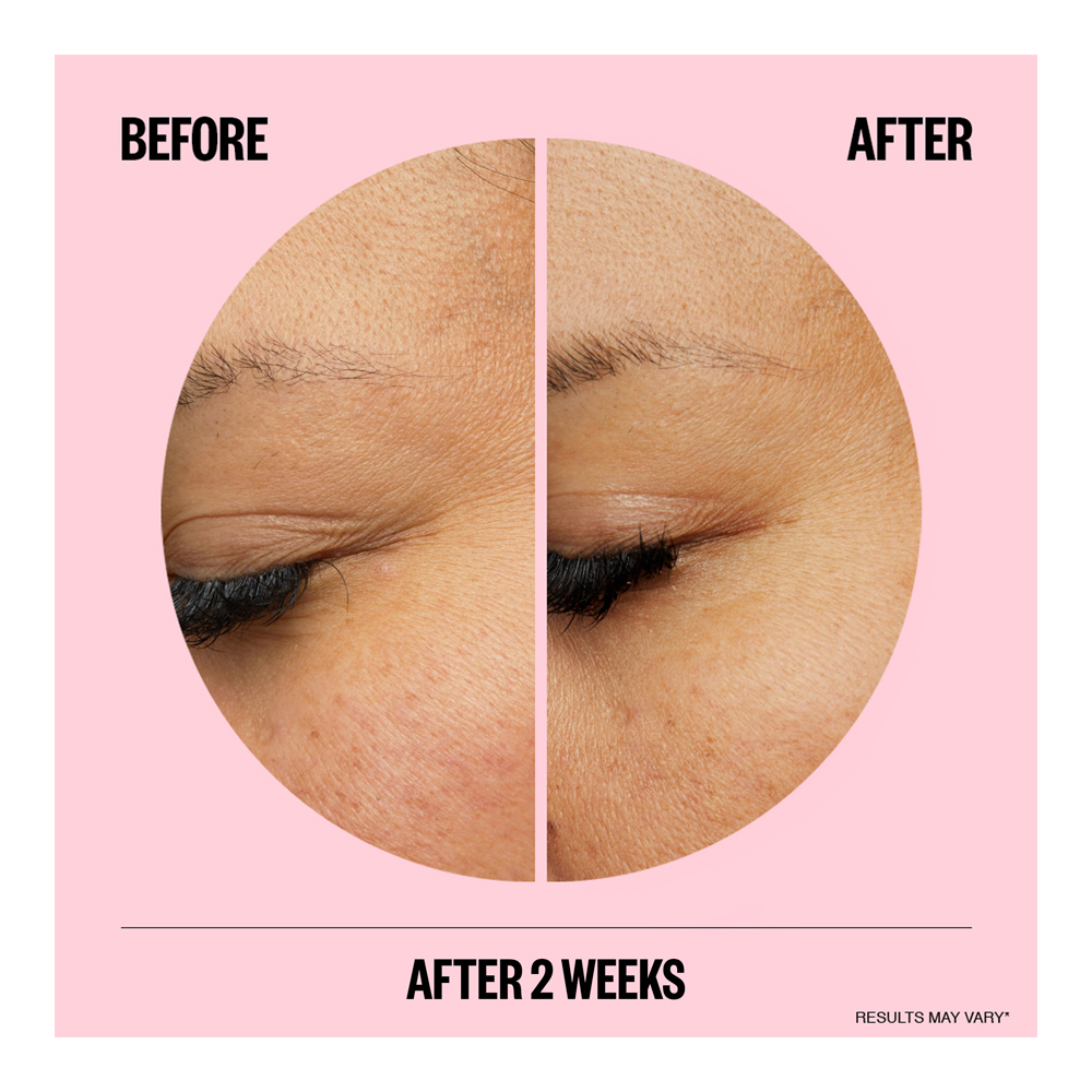 Wrinkles Microneedling Patches - 6 Pieces