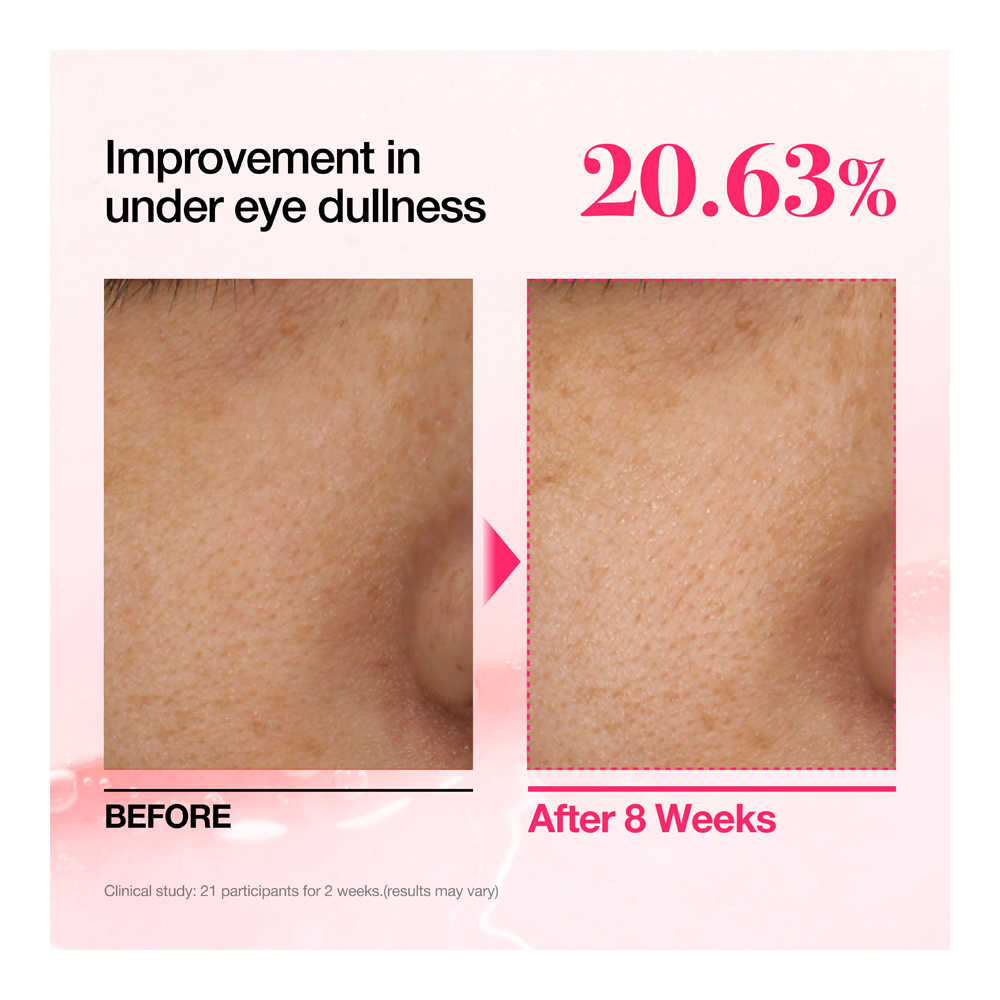 Niacinamide 5 TXA Brightening Pad - 60 Pads