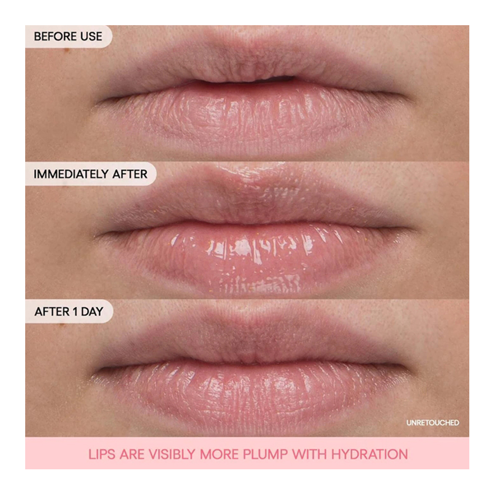 Bouncy & Firm Lip Treatment - 12 G