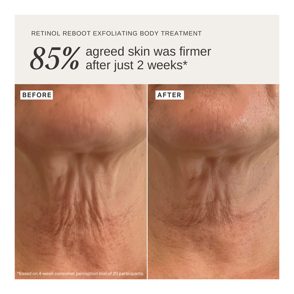 Retinol Reboot Exfoliating Body Treatment - 120ml