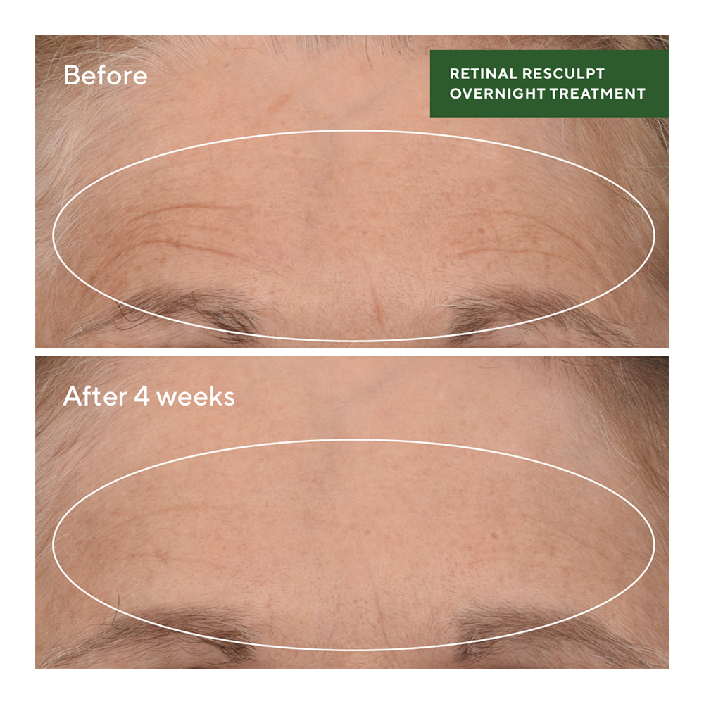 Retinal Resculpt Overnight Treatment - 30ml
