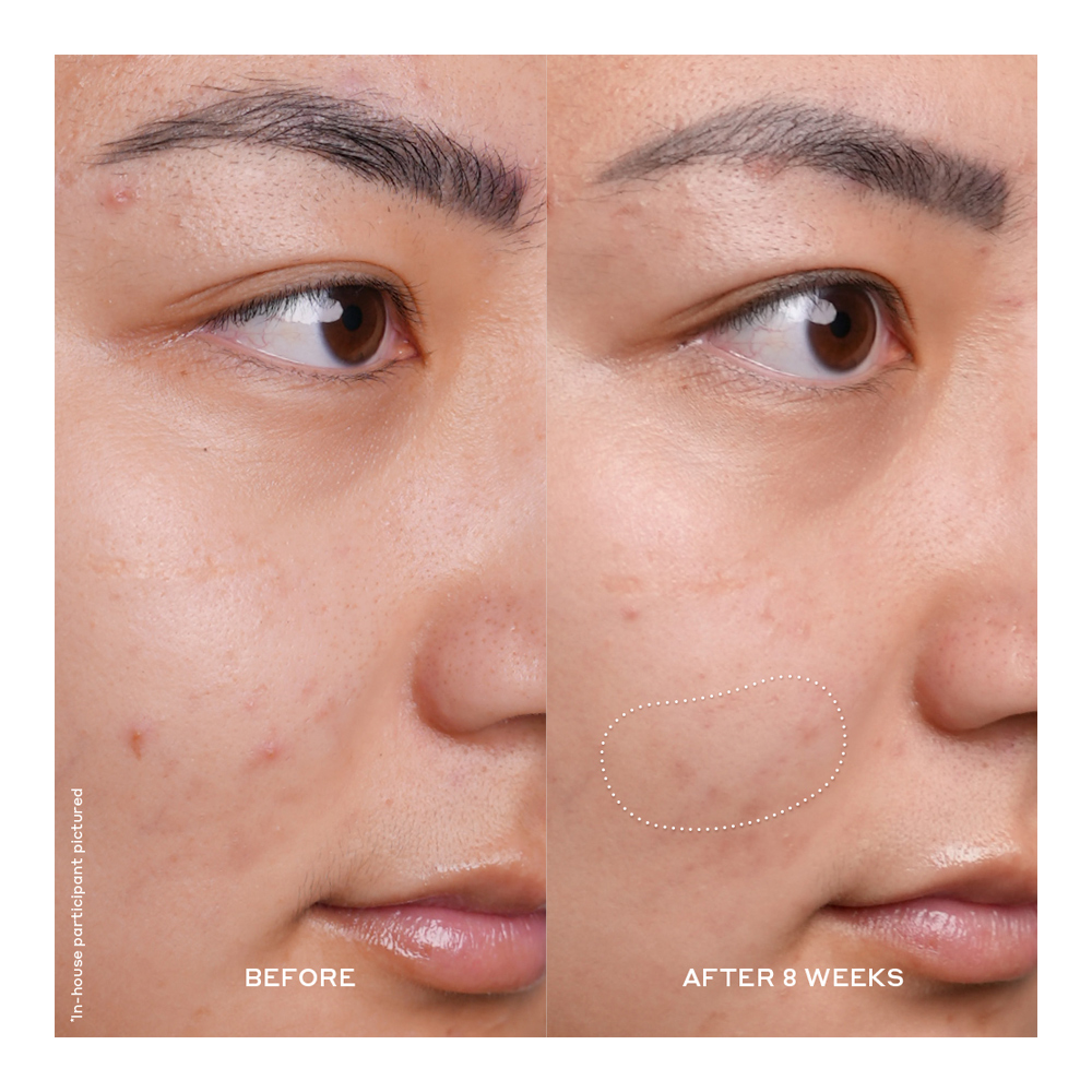 Banana Bright Vitamin C Serum - 30ml