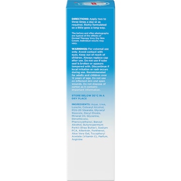 Dermal Therapy Very Dry Skin Cream 125g