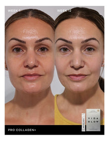 Pro Collagen +