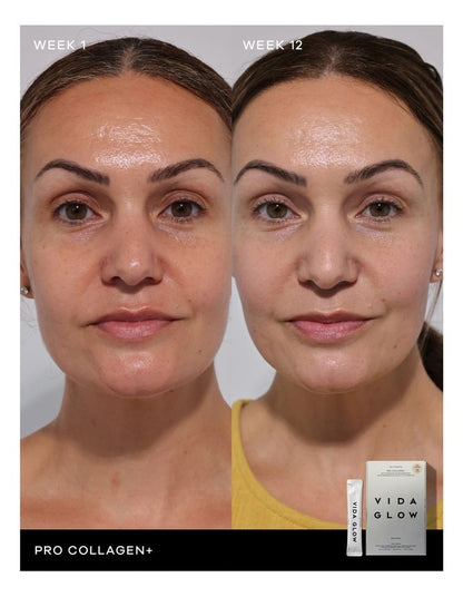 Pro Collagen +