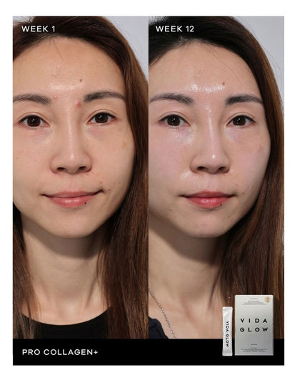 Pro Collagen +