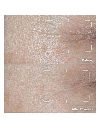 Smart Clinical Repair SPF 15 Wrinkle Correcting Cream 50ml