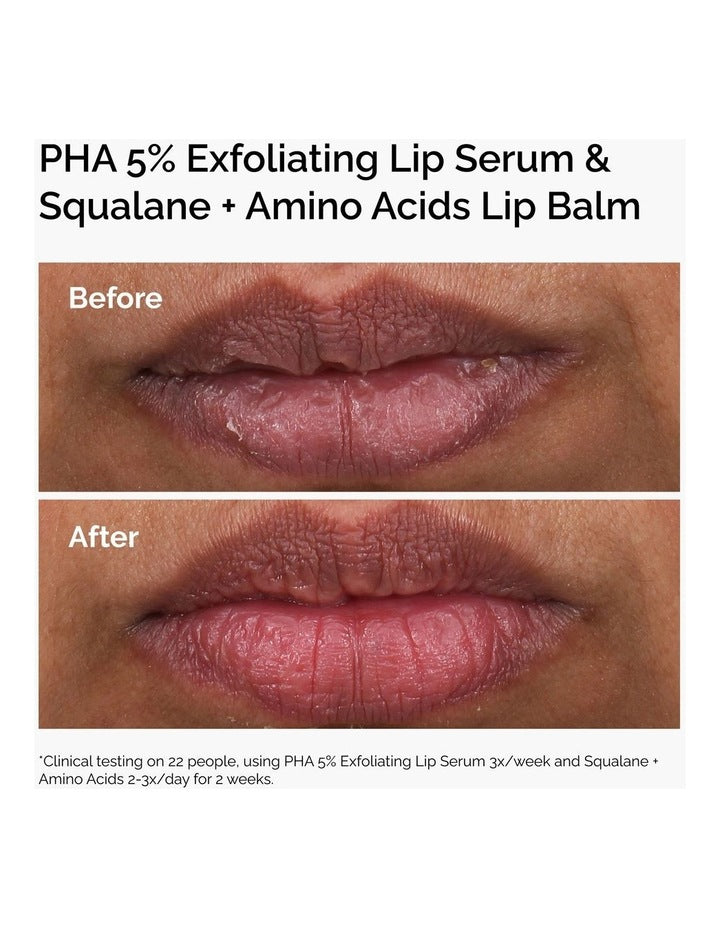 Squalane + Amino Acids Hydrating Lip Balm for Lips, Elbows and Cuticles 15ml