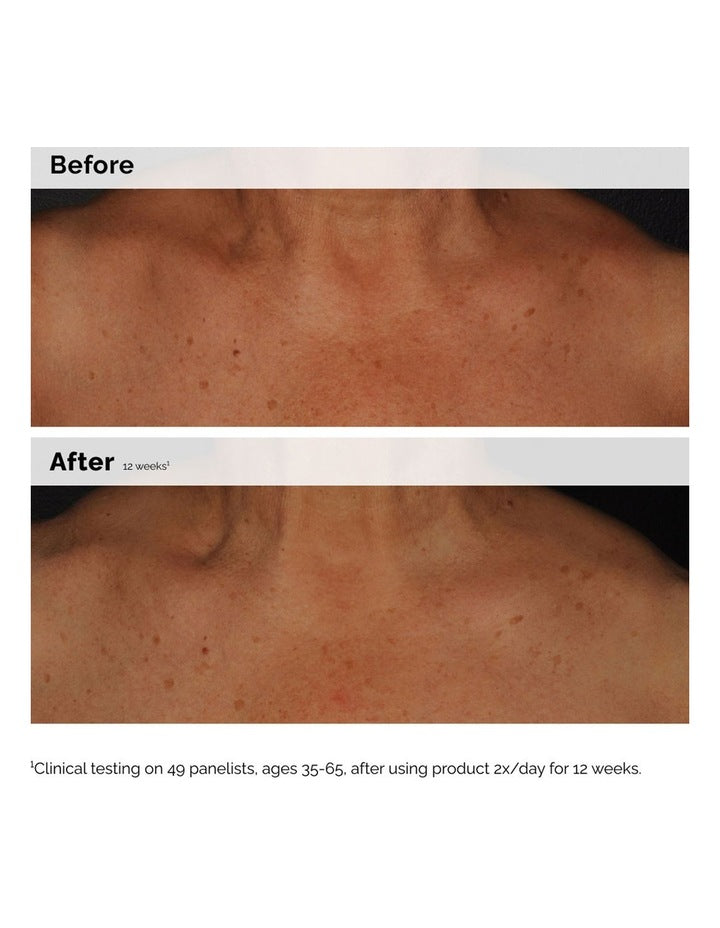 Niacinamide 5% Face and Body Emulsion for Dark Spots & Uneven Tone 100ml