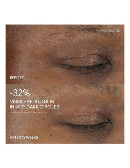 Hyper Real Serumizer Eye 15ml