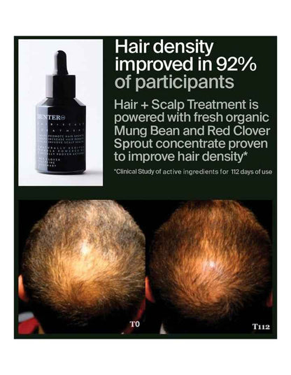 Hair and Scalp Treatment
