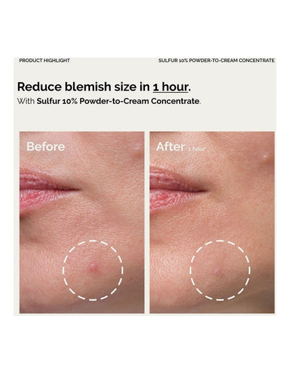 Sulfur 10% Powder-to-Cream Concentrate Fast-Acting Spot Solution for Blemish-Prone Skin 5g