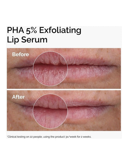 PHA 5% Lip Exfoliating Sreum