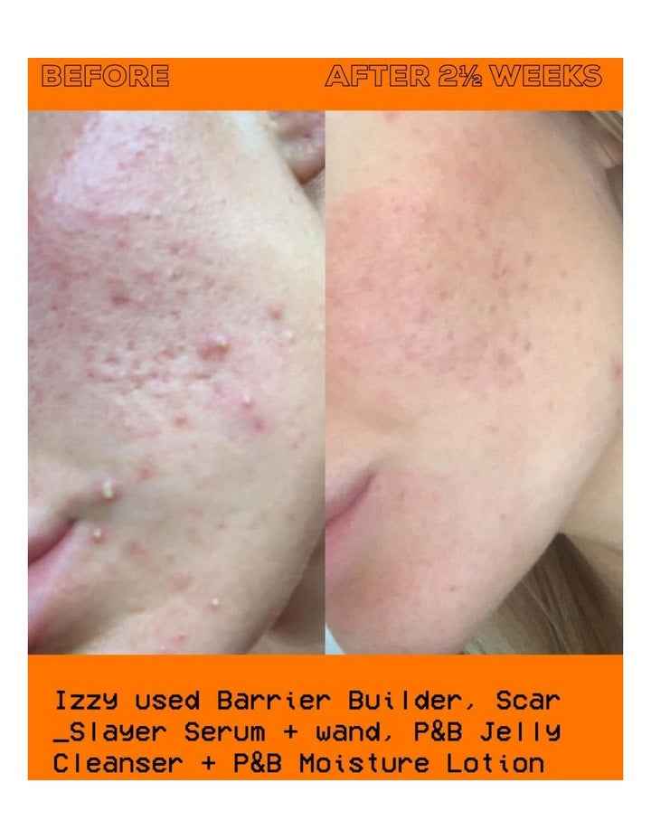 The Scar Slayer Facial Serum 30ml