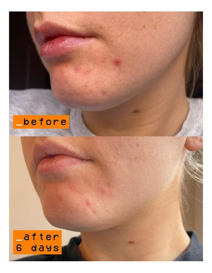 Scar Slayer Wand 15ml