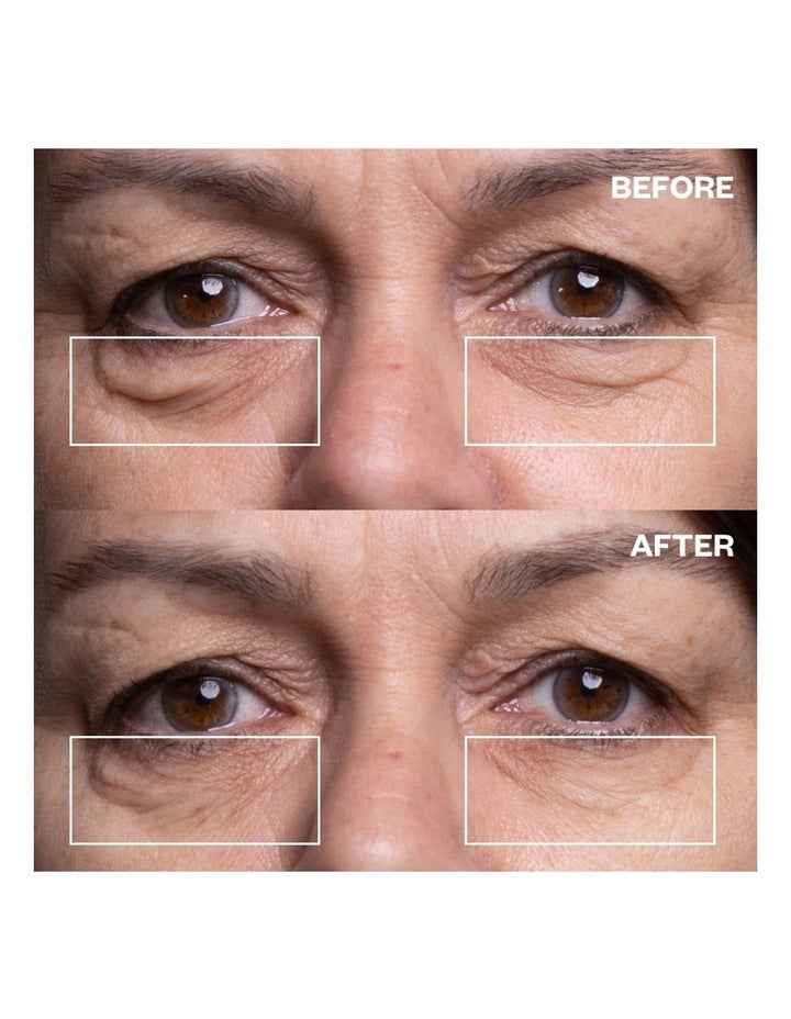 Eye Wrinkle Patches - 3 Pairs of Patches