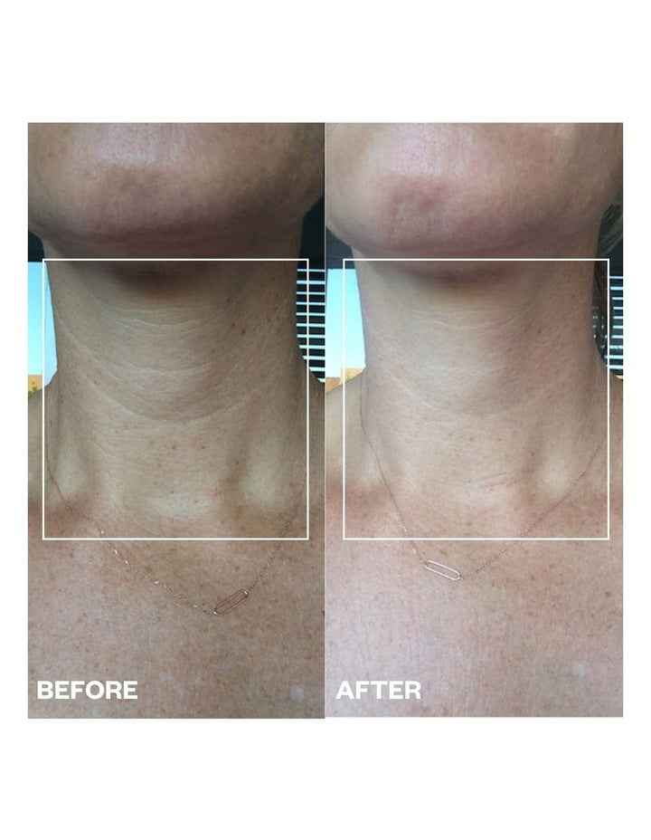 Neck Wrinkle Patch - 1 Patch