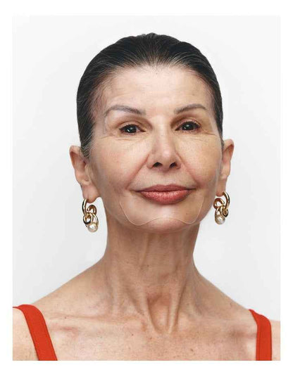 Mouth & Lip Wrinkle Patches - 2 Patches