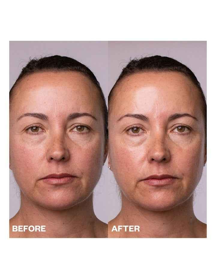 Face, Neck & Decolletage Polishing Peel Pads - 5 Towelletes