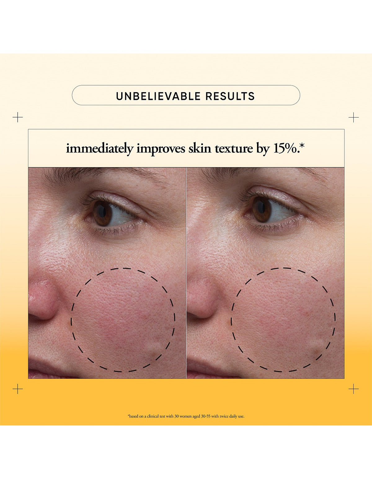 the microdelivery resurfacing solution 150ml