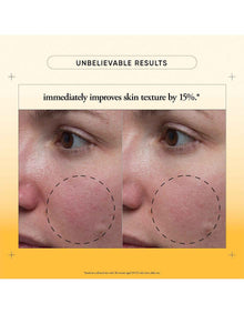 the microdelivery resurfacing solution 150ml