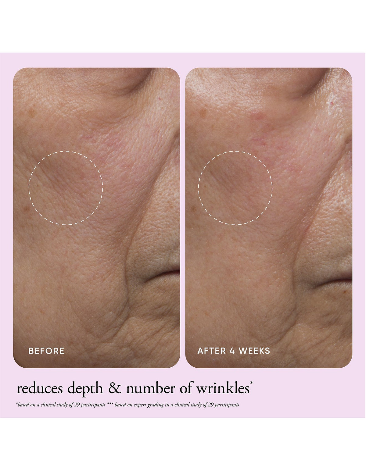 ultimate miracle worker nourish & rejuvenate face & neck cream 60ml