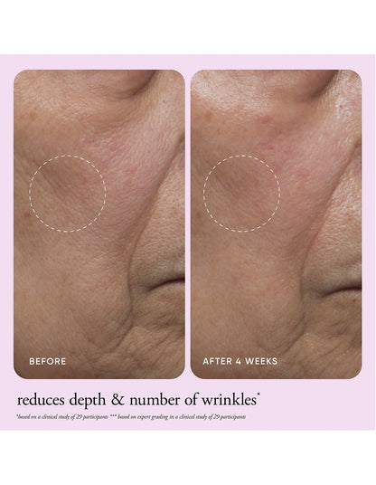 ultimate miracle worker nourish & rejuvenate face & neck cream 60ml