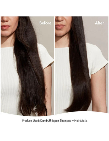 DANDRUFF REPAIR SHAMPOO 300ML
