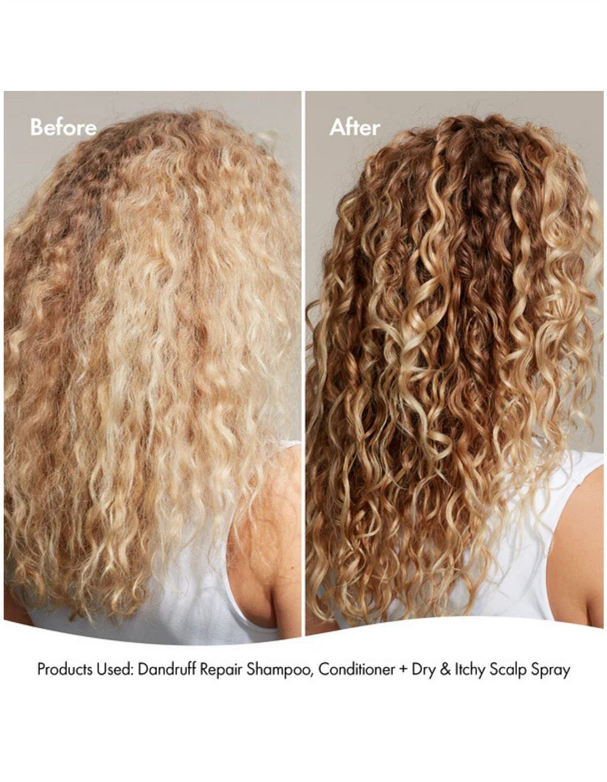 DANDRUFF REPAIR CONDITIONER 300ML