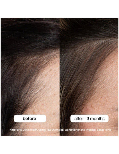 HG ANTI-THINNING SHAMPOO 500ML