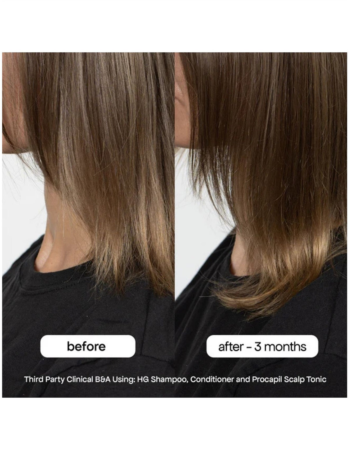 HG ANTI-THINNING CONDITIONER 500ML