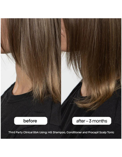 HG ANTI-THINNING CONDITIONER 500ML