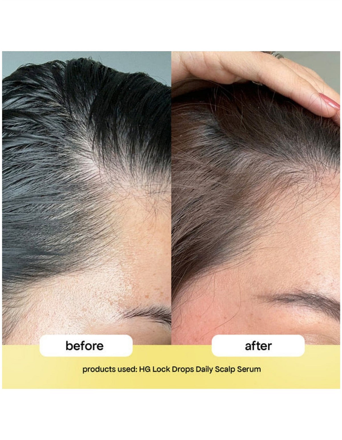 HG LOCK DROPS ANTI-SHEDDING SCALP & HAIR SERUM 30ML