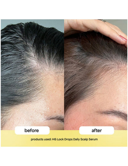 HG LOCK DROPS ANTI-SHEDDING SCALP & HAIR SERUM 30ML