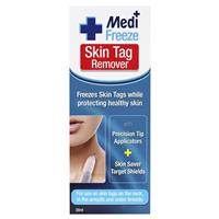 Medi Freeze Skin Tag Remover - GimmeNow