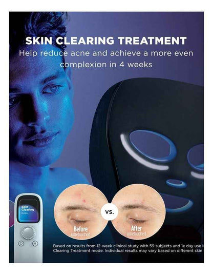CryoGlow Cooling + LED Face Mask FW312ANZ