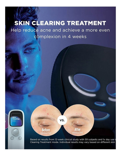 CryoGlow Cooling + LED Face Mask FW312PLANZ