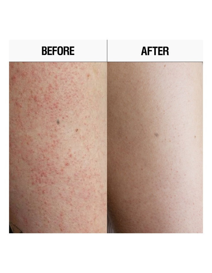 Resurfacing Targeted Body Cleanser 300ml