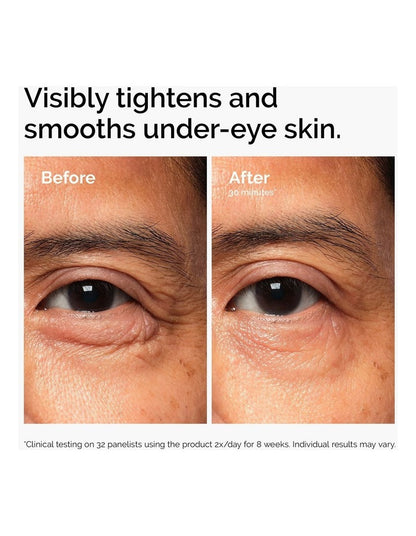 Lacto-PDRN* 4% + B9 Eye Cream