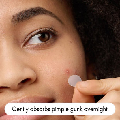 Hero 24 Pack Mighty Patch The Original Pimple Patches - Hydrocolloid