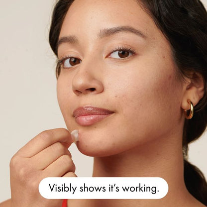 Hero 24 Pack Mighty Patch The Original Pimple Patches - Hydrocolloid