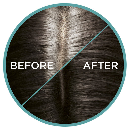 L'Oréal Paris Magic Retouch 8 Cool Dark Brown 75mL - GimmeNow