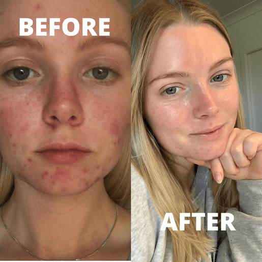 BOOST LAB Vitamin B3 Blemish Rescue Serum 30mL - GimmeNow