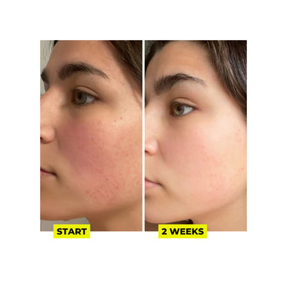 BORING WITHOUT YOU For Face Sake™ Multi-Mask 100g