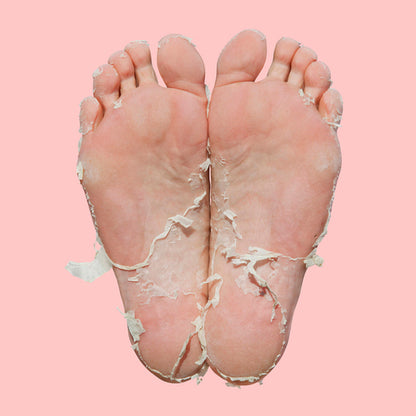 Skin Republic Biodegradable Foot Peel 40mL