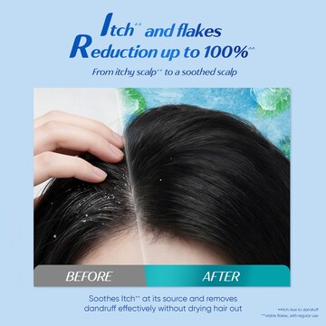Head & Shoulders 72Hr Itch Defense Shampoo 345mL